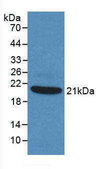 Tumor Necrosis Factor Alpha (TNFa) Rabbit Monoclonal Antibody