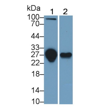 Tumor Necrosis Factor Receptor Superfamily, Member 10C (TNFRSF10C) Human Monoclonal Antibody