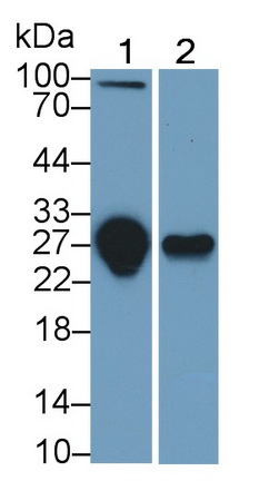 Tumor Necrosis Factor Receptor Superfamily, Member 10C (TNFRSF10C) Human Monoclonal Antibody