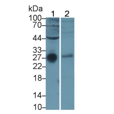 Tumor Necrosis Factor Receptor Superfamily, Member 10C (TNFRSF10C) Human Monoclonal Antibody