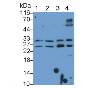 Tumor Necrosis Factor Related Apoptosis Inducing Ligand (TRAIL) Human Monoclonal Antibody