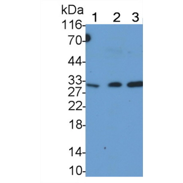 Tumor Necrosis Factor Related Apoptosis Inducing Ligand (TRAIL) Human Monoclonal Antibody
