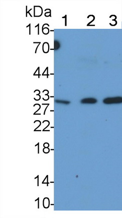 Tumor Necrosis Factor Related Apoptosis Inducing Ligand (TRAIL) Human Monoclonal Antibody