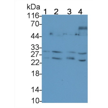 Tumor Necrosis Factor Related Apoptosis Inducing Ligand (TRAIL) Human Monoclonal Antibody