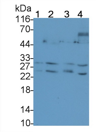 Tumor Necrosis Factor Related Apoptosis Inducing Ligand (TRAIL) Human Monoclonal Antibody