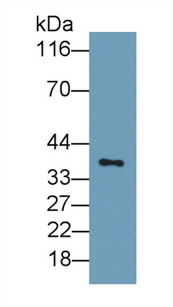 Plasminogen Activator, Urokinase Receptor (uPAR) Rat Monoclonal Antibody