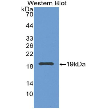 Vascular Endothelial Growth Factor A (VEGFA) Human Monoclonal Antibody
