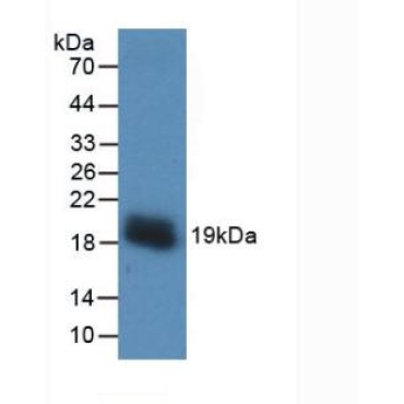 Vascular Endothelial Growth Factor A (VEGFA) Human Monoclonal Antibody