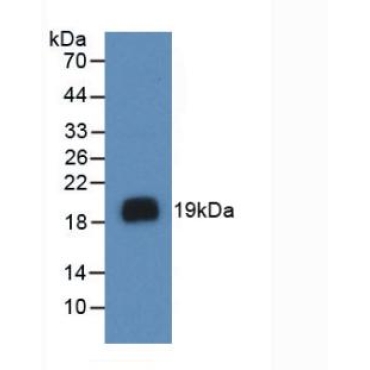 Vascular Endothelial Growth Factor A (VEGFA) Human Monoclonal Antibody