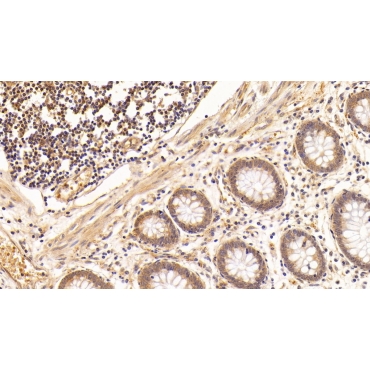 Vascular Endothelial Growth Factor C (VEGFC) Human Monoclonal Antibody