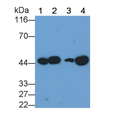 Vascular Endothelial Growth Factor C (VEGFC) Mouse Monoclonal Antibody