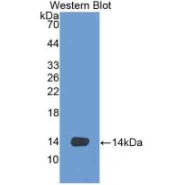 Vascular Endothelial Growth Factor D (VEGFD) Human Monoclonal Antibody