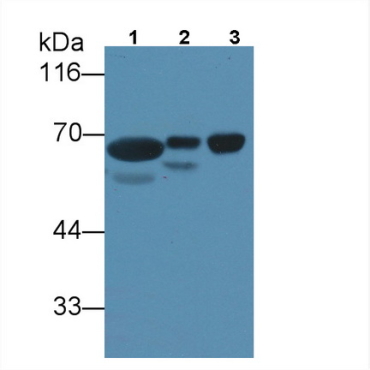 Alpha-Fetoprotein (AFP) Human Monoclonal Antibody