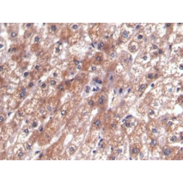 Alpha-Fetoprotein (AFP) Human Monoclonal Antibody