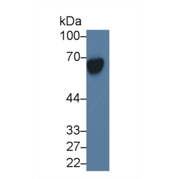 Alpha-Fetoprotein (AFP) Human Monoclonal Antibody