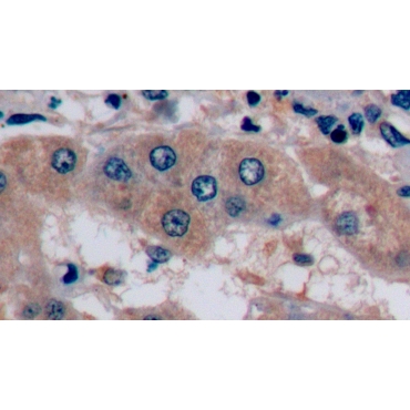Alpha-Fetoprotein (AFP) Human Monoclonal Antibody