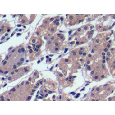 Alpha-Fetoprotein (AFP) Human Monoclonal Antibody