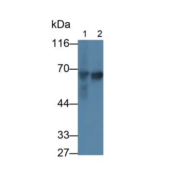 Alpha-Fetoprotein (AFP) Human Monoclonal Antibody