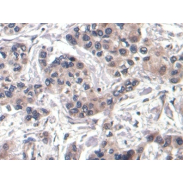 Alpha-Fetoprotein (AFP) Human Monoclonal Antibody