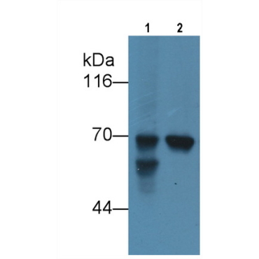 Alpha-Fetoprotein (AFP) Human Monoclonal Antibody