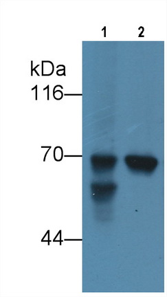 Alpha-Fetoprotein (AFP) Human Monoclonal Antibody