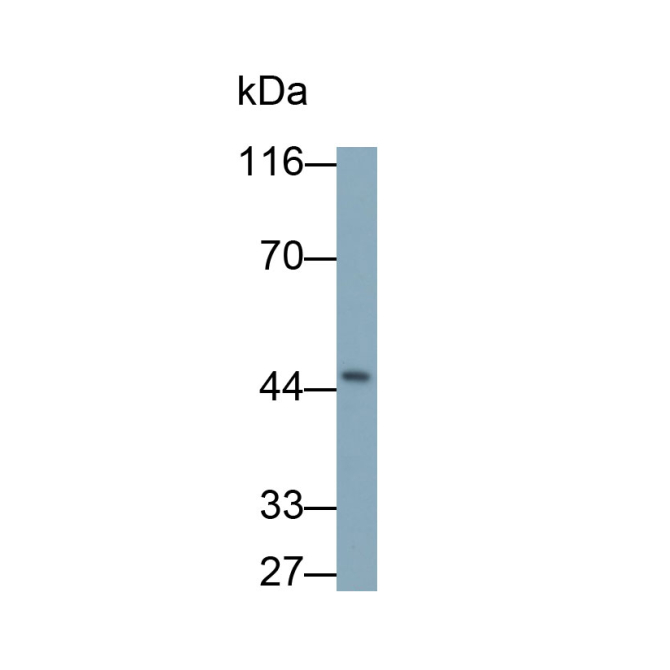 Carbohydrate Antigen 19-9 (CA19-9) Human Monoclonal Antibody