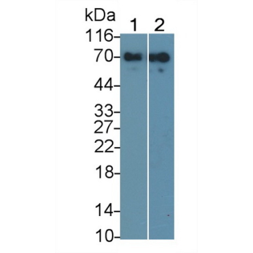 Alpha 2-Antiplasmin (a2PI) Human Monoclonal Antibody
