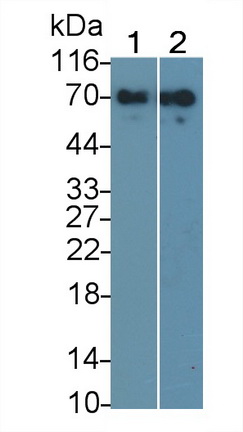 Alpha 2-Antiplasmin (a2PI) Human Monoclonal Antibody