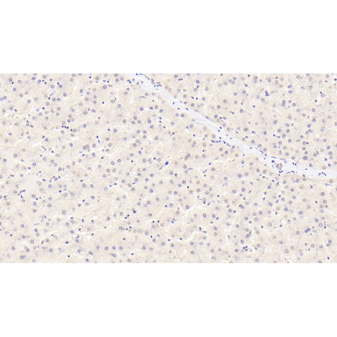 Alpha 2-Antiplasmin (a2PI) Human Monoclonal Antibody