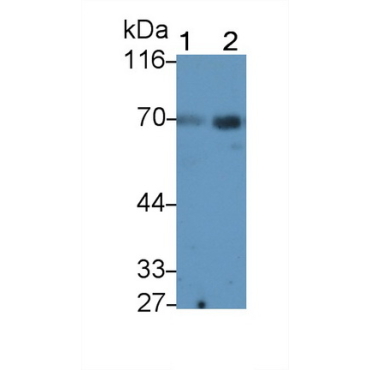 Alpha 2-Antiplasmin (a2PI) Human Monoclonal Antibody