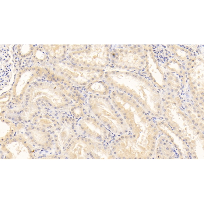 Alpha 2-Antiplasmin (a2PI) Human Monoclonal Antibody