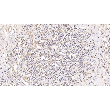 Ubiquitin (Ub) Human Monoclonal Antibody