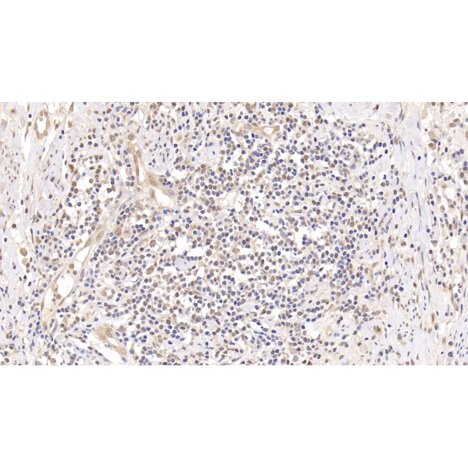 Ubiquitin (Ub) Human Monoclonal Antibody