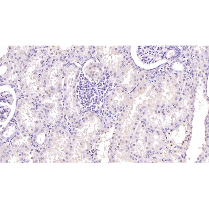 Ubiquitin (Ub) Human Monoclonal Antibody