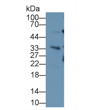 Ubiquitin (Ub) Human Monoclonal Antibody