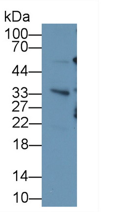 Ubiquitin (Ub) Human Monoclonal Antibody