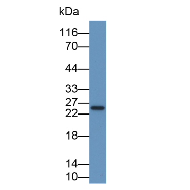 Interferon Alpha 2 (IFNa2) Human Monoclonal Antibody
