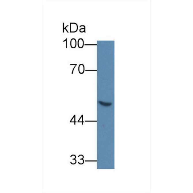 Galactosidase Alpha (GLa) Human Monoclonal Antibody