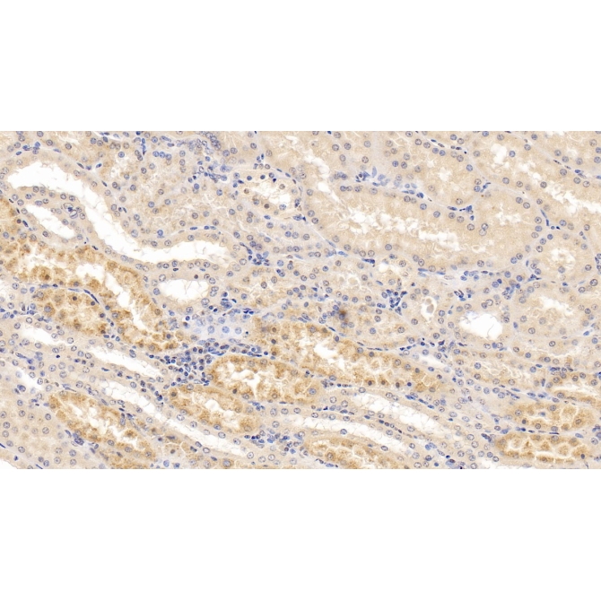 Galactosidase Alpha (GLa) Human Monoclonal Antibody