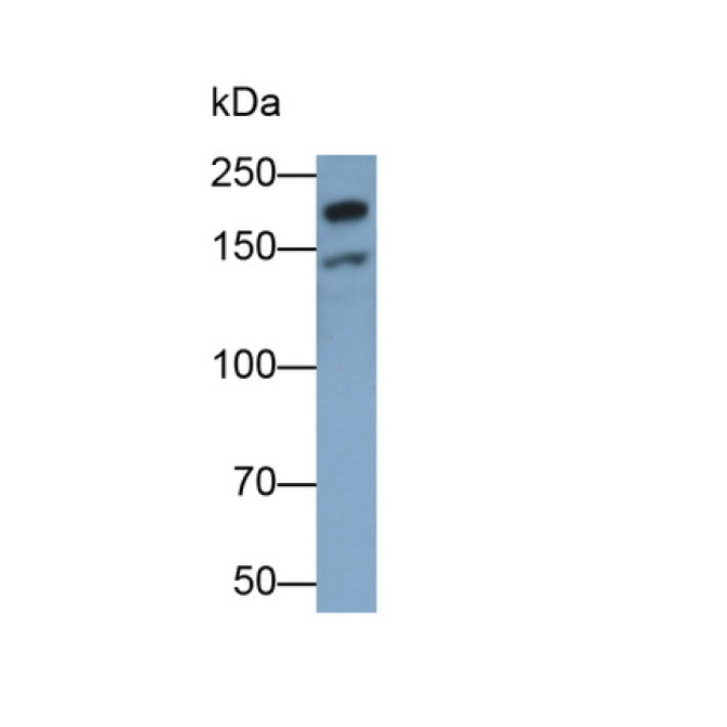 Laminin Beta 1 (LAMb1) Human Monoclonal Antibody