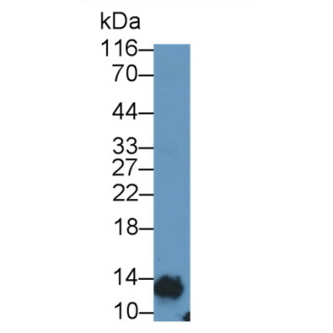 Glycated Hemoglobin A1c (HbA1c) Human Monoclonal Antibody