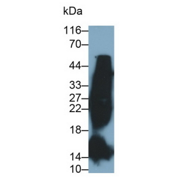 Glycated Hemoglobin A1c (HbA1c) Human Monoclonal Antibody