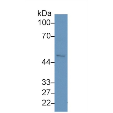 Fibrinogen (FG) Human Monoclonal Antibody