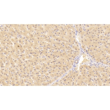 Alanine Aminotransferase (ALT) Human Monoclonal Antibody