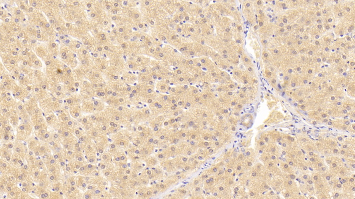 Alanine Aminotransferase (ALT) Human Monoclonal Antibody