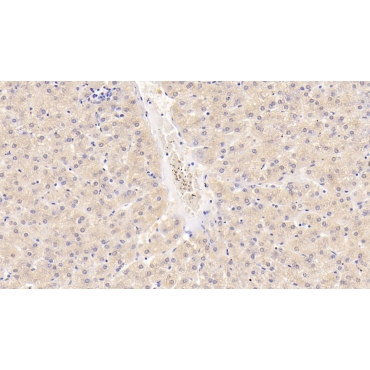 Alanine Aminotransferase (ALT) Human Monoclonal Antibody