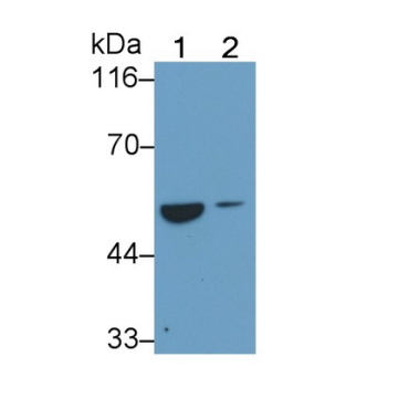 Alanine Aminotransferase (ALT) Human Monoclonal Antibody