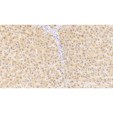 Alanine Aminotransferase (ALT) Human Monoclonal Antibody