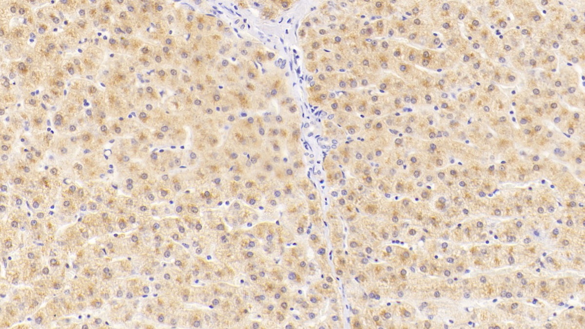 Alanine Aminotransferase (ALT) Human Monoclonal Antibody
