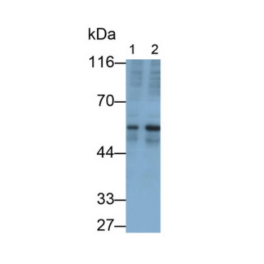 Transforming Growth Factor Beta 2 (TGFb2) Human Monoclonal Antibody
